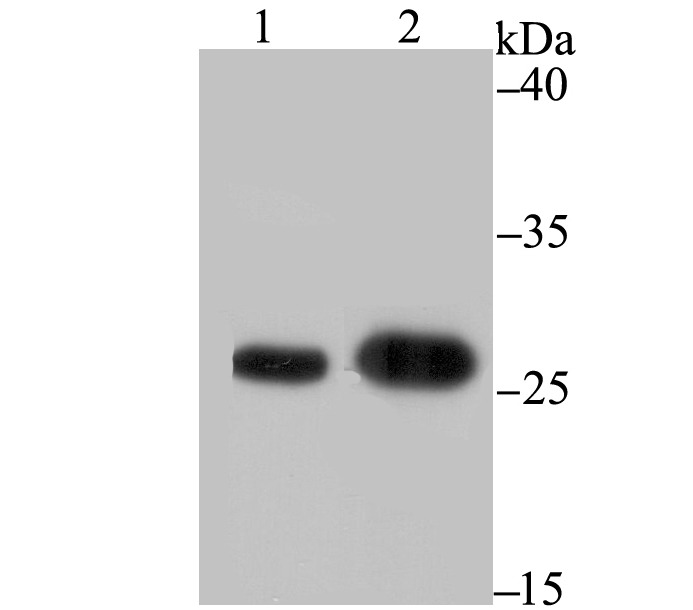 Anti-BCAP31 Antibody (4P206)