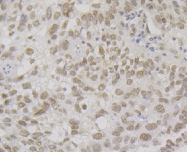 Anti-BAF57 Antibody (2O20)