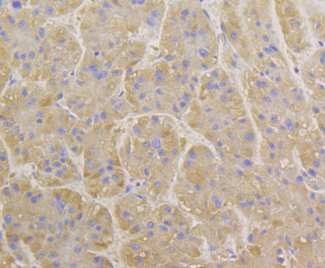 Anti-BCAP31 Antibody (4P206)