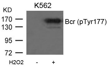 Anti-Phospho-Bcr (Tyr177) Polyclonal Antibody