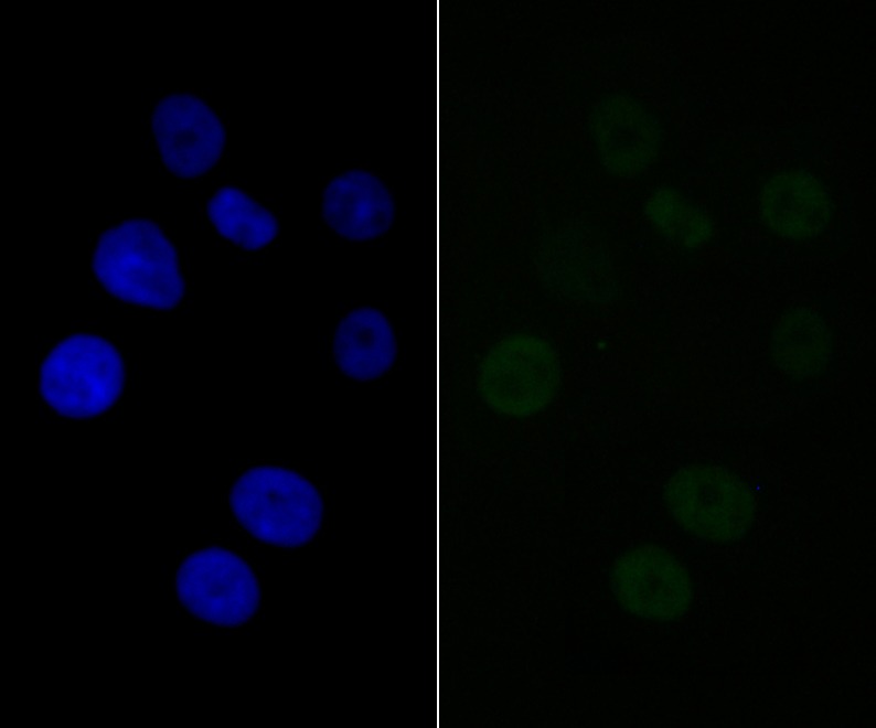 Anti-BAF57 Antibody (2O20)