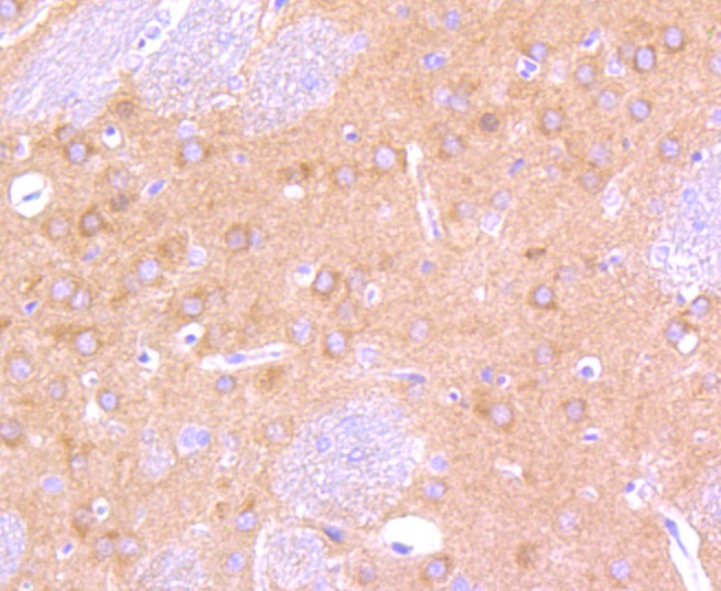 Anti-BRAF Antibody (7W36)
