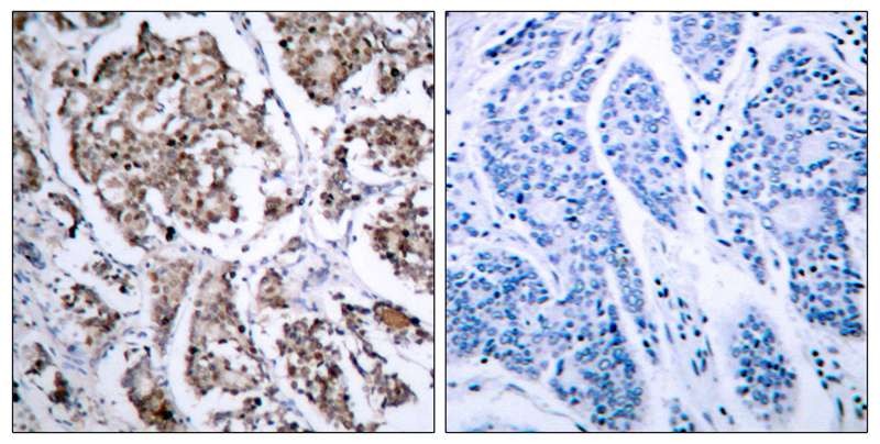 Anti-Phospho-Bad (Ser155) Polyclonal Antibody