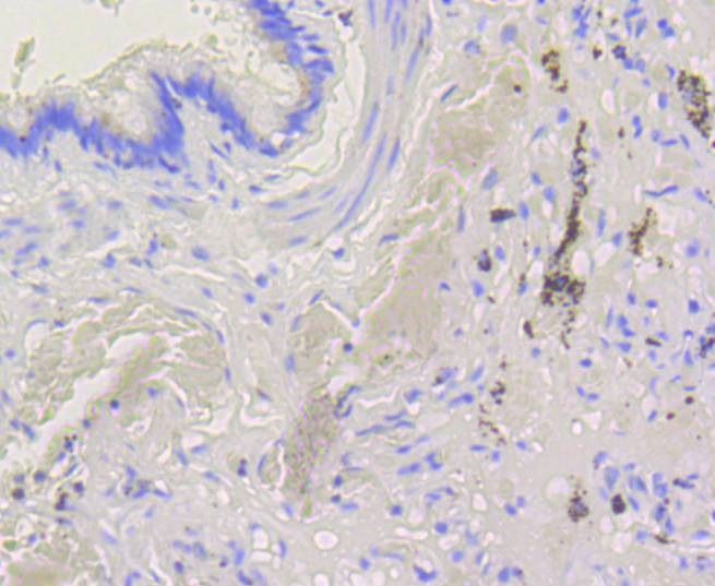 Anti-BAK1 Antibody (2V22)