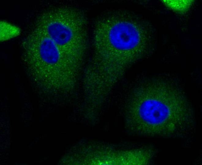 Anti-Bad Antibody (4Z819)