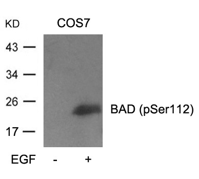 Anti-Phospho-Bad (Ser112) Polyclonal Antibody
