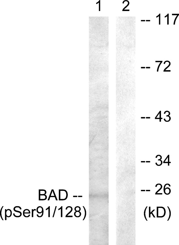 Anti-Phospho-Bad (Ser91, 128) Polyclonal Antibody