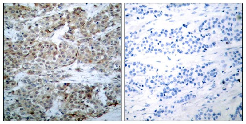 Anti-Phospho-Bad (Ser112) Polyclonal Antibody