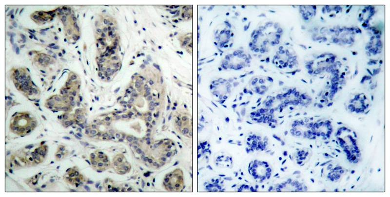 Anti-Phospho-Bad (Ser136) Polyclonal Antibody
