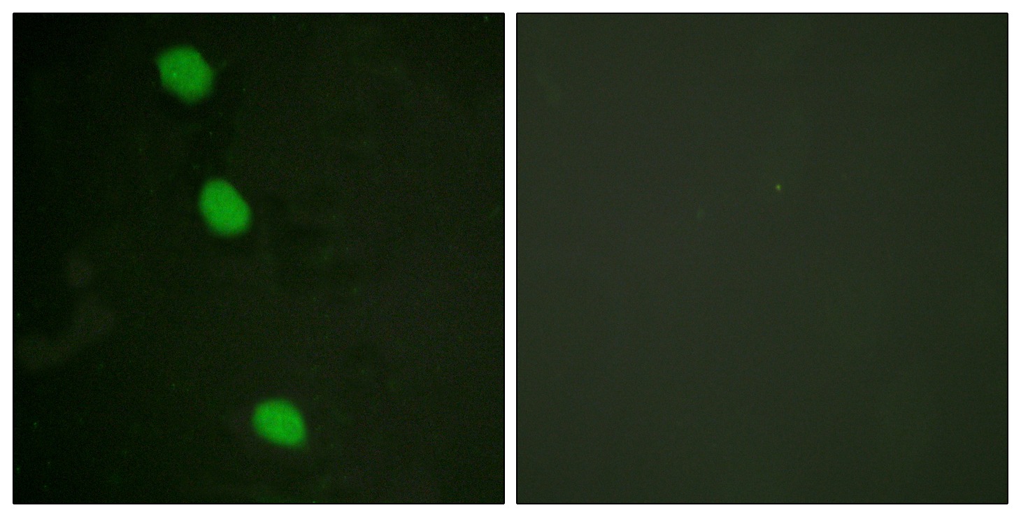 Anti-Phospho-CAMKIV (Thr196, 200) Polyclonal Antibody