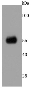 Anti-CAMKII alpha Antibody (4A308)