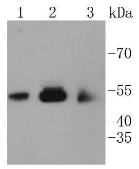 Anti-CaMK2 Antibody (2O871)