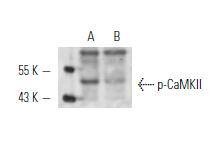 Anti-Phospho-CaMK2 (Thr286) Antibody (9U416)