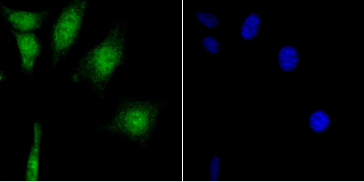 Anti-CAMKIV Antibody (5K734)