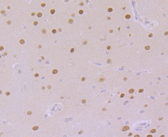 Anti-CAMKIV Antibody (5K734)