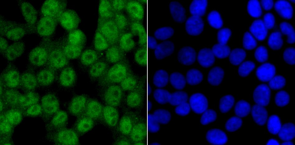 Anti-CAMKIV Antibody (5K734)