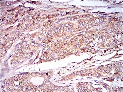 Anti-CAMK2G Antibody (8A304)