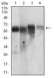 Anti-CAMK2G Antibody (8A304)
