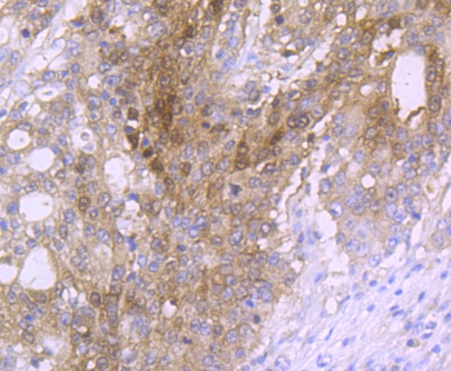 Anti-Carbonic Anhydrase 2 Antibody (5N337)