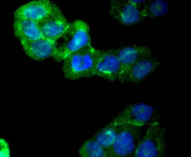 Anti-CaMK2 Antibody (2O871)