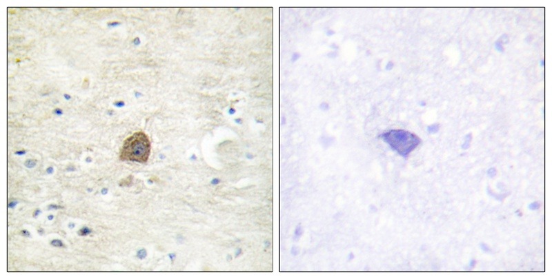 Anti-Phospho-CAMKII alpha/beta/gamma (Thr305) Polyclonal Antibody 2