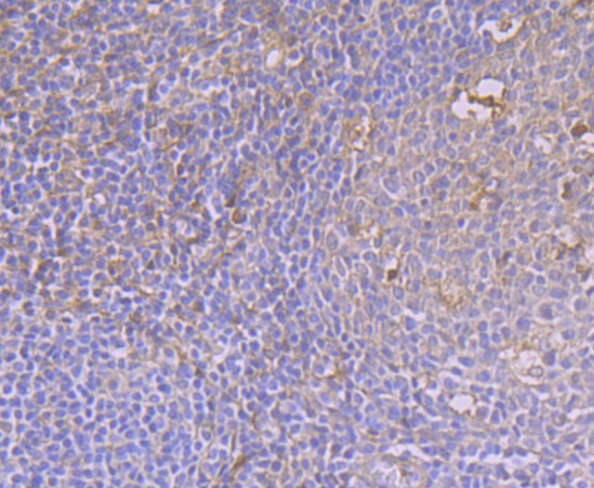 Anti-CAMKIV Antibody (5K734)