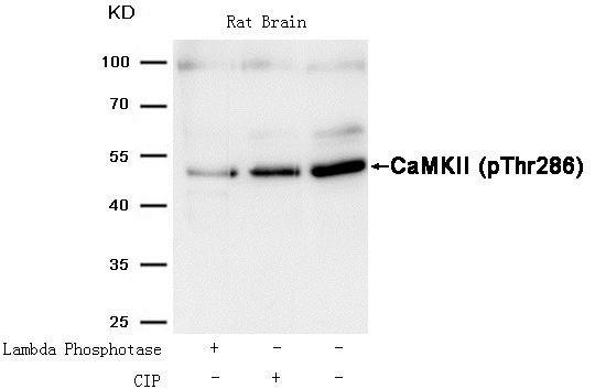 Anti-Phospho-CaMK2 (Thr286) Polyclonal Antibody