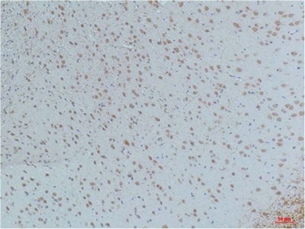 Anti-Phospho-CAMKII beta/gamma/delta (Thr287) Antibody (7V57)