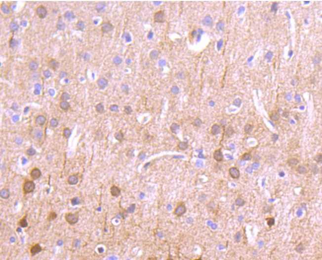 Anti-CAMK2D Antibody (7Z493)