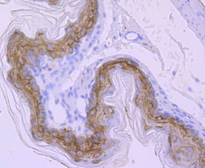 Anti-Carbonic Anhydrase 2 Antibody (5N337)