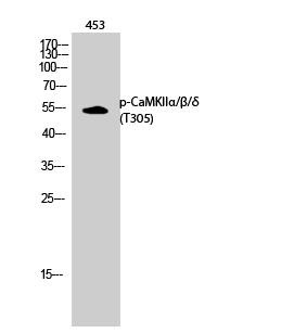 Anti-Phospho-CAMKII alpha/beta/gamma (Thr305) Polyclonal Antibody 2