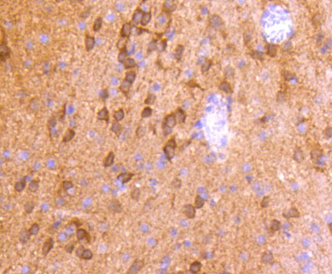 Anti-CaMK2 Antibody (2O871)