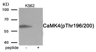 Anti-Phospho-CAMKIV (Thr196, 200) Polyclonal Antibody
