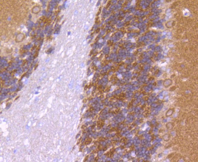 Anti-CaMK2 Antibody (2O871)