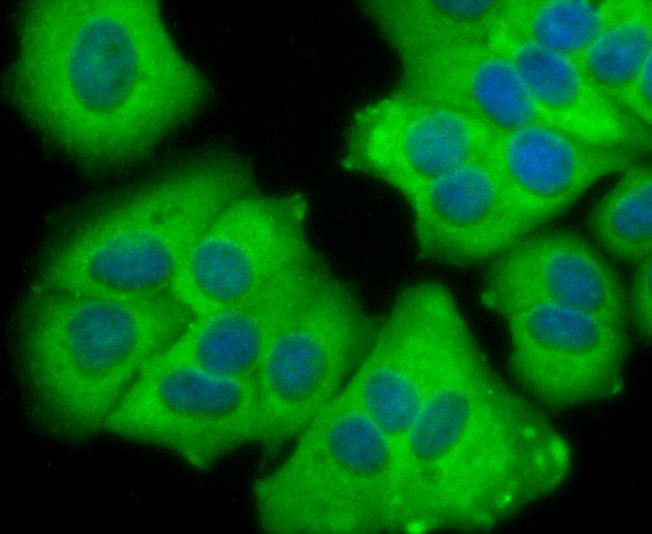 Anti-CEACAM5 Antibody (1I250)