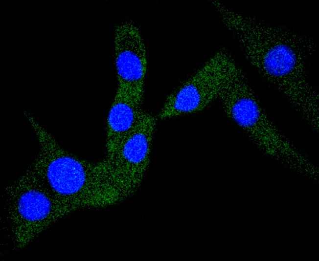 Anti-TNNI3 Antibody (8F759)