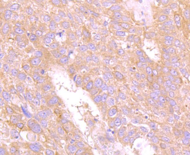 Anti-CEACAM5 Antibody (1I250)