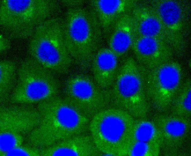 Anti-CAV1 Antibody (1U205)