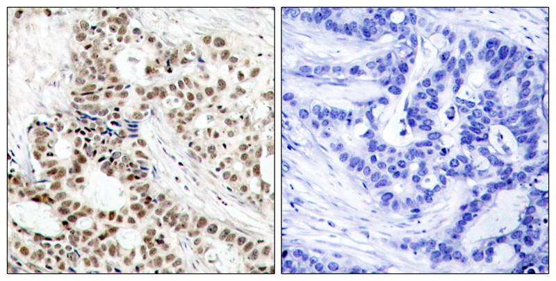 Anti-Phospho-BRCA1 (Ser1423) Polyclonal Antibody