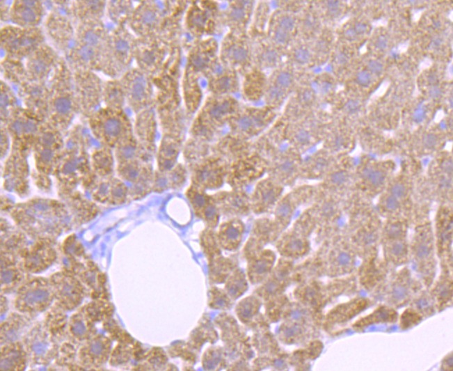 Anti-Catalase/CAT Antibody (3Q335)