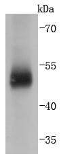Anti-Carbonic Anhydrase 9 Antibody (8K855)