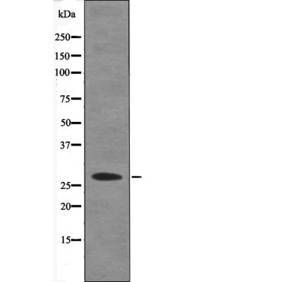 Anti-Phospho-Caveolin 2 (Ser36) Polyclonal Antibody