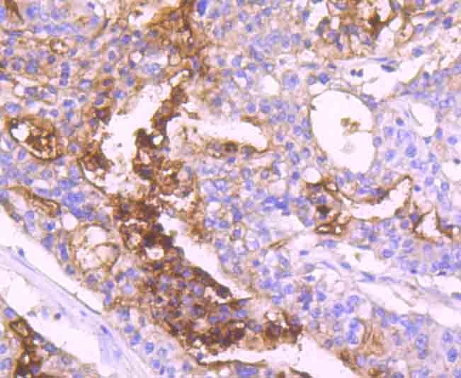 Anti-CEACAM5 Antibody (1I250)