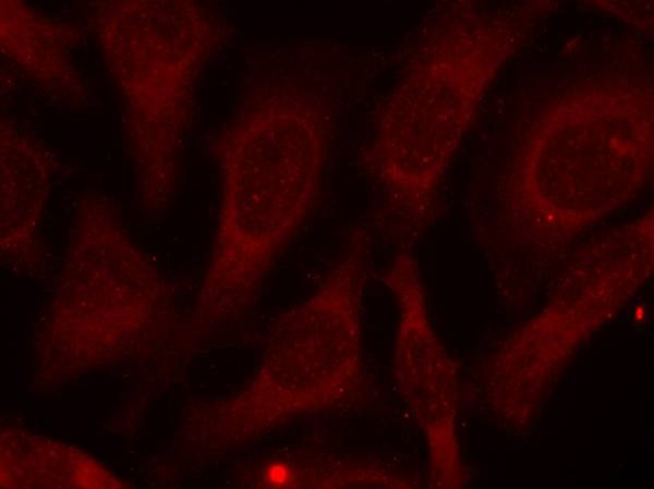 Anti-Phospho-CARM1 (Ser228) Polyclonal Antibody