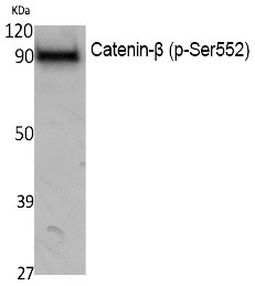 Anti-Phospho-CTNNB1 (Ser552) Polyclonal Antibody