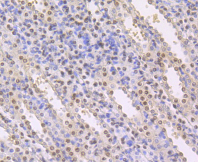 Anti-CBFB Antibody (1I567)