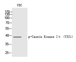 Anti-Phospho-CK1 alpha/CSNK1A1 (Tyr321) Polyclonal Antibody