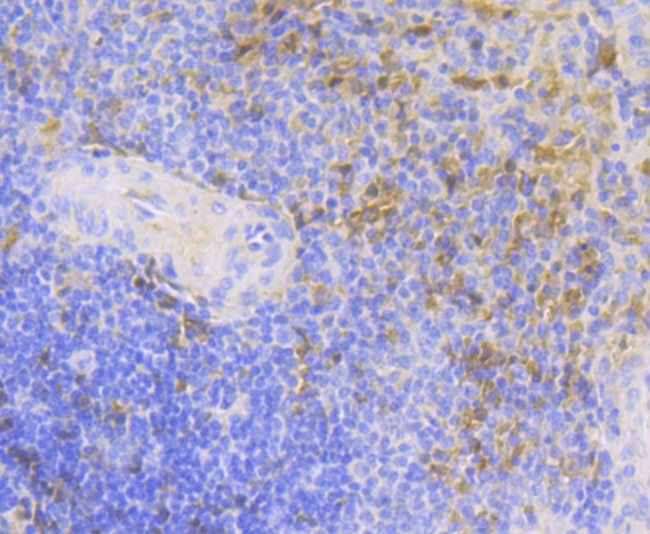 Anti-Carbonic Anhydrase 1 Antibody (2E643)