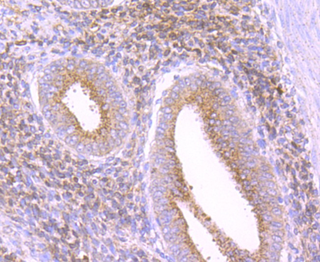 Anti-Catalase/CAT Antibody (3Q335)