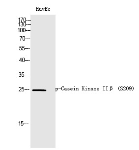 Anti-Phospho-Casein Kinase IIβ (Ser209) Polyclonal Antibody